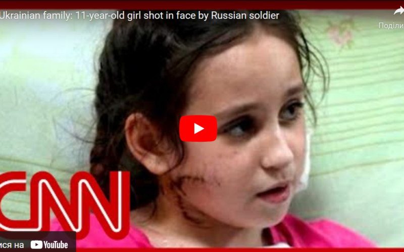 In Mariupol, Russian aggressor shot an 11-year-old girl in the face.